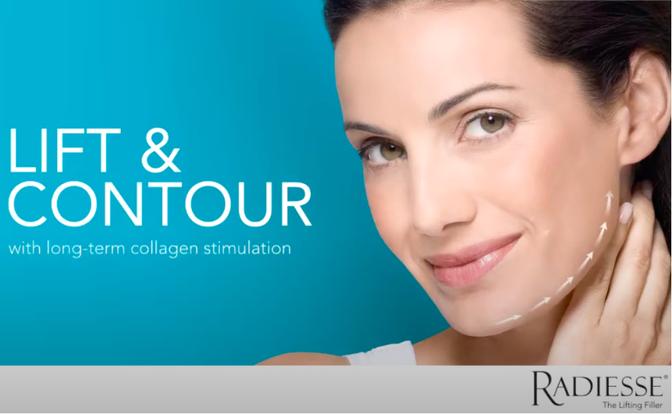 Radiesse image with text lift and contour